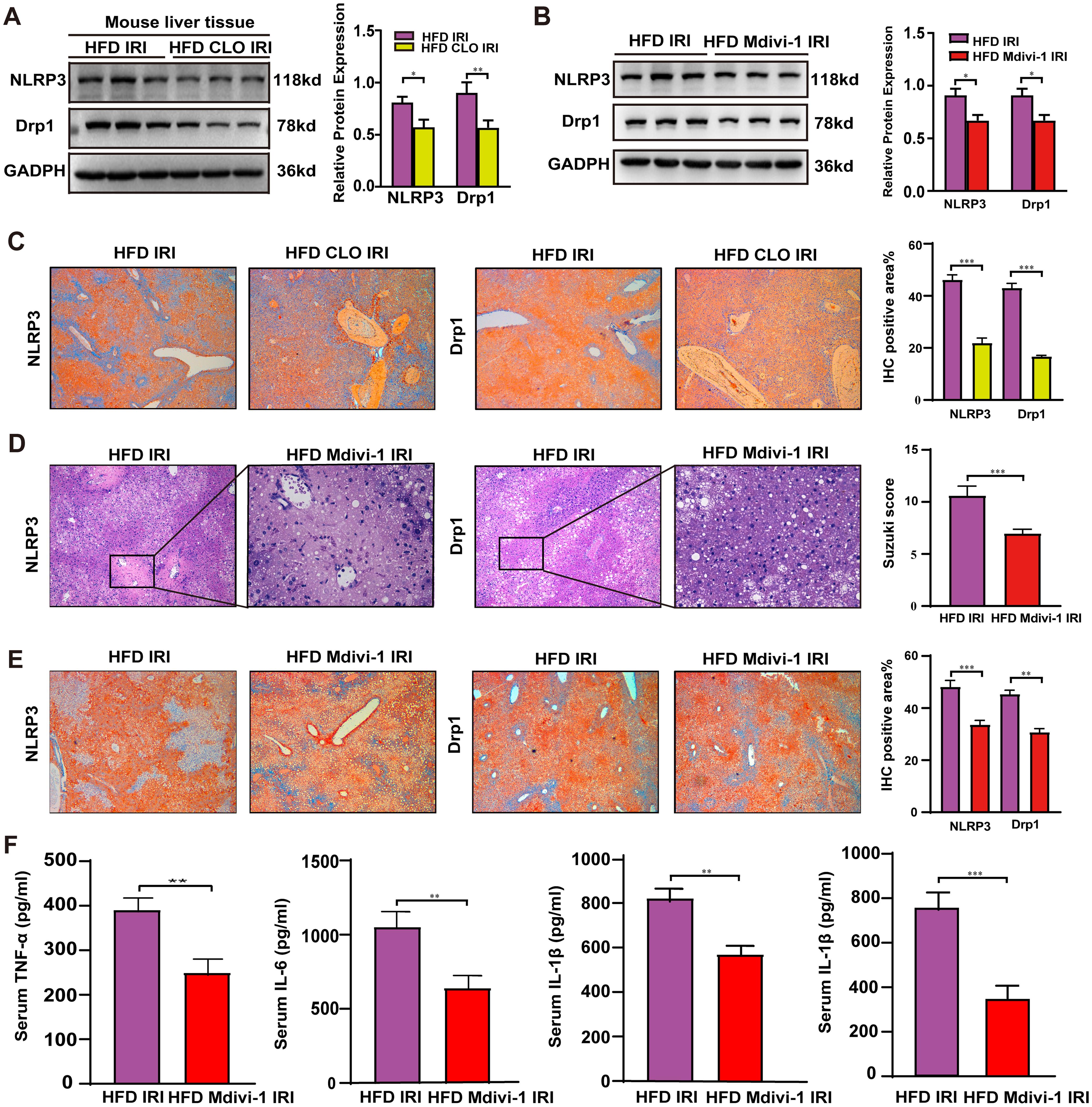 Inhibition of Drp1 down-regulated NLRP3 expression and reduce IRI in hepatic steatosis.
